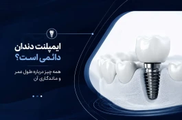 ایمپلنت دندان دائمی است؟ همه چیز درباره طول عمر و ماندگاری آن